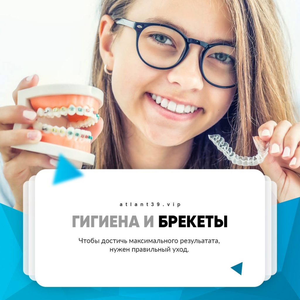 Гигиена и Брекеты